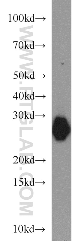 Western Blot (WB) analysis of mouse heart tissue using MYL3 Polyclonal antibody (10913-1-AP)