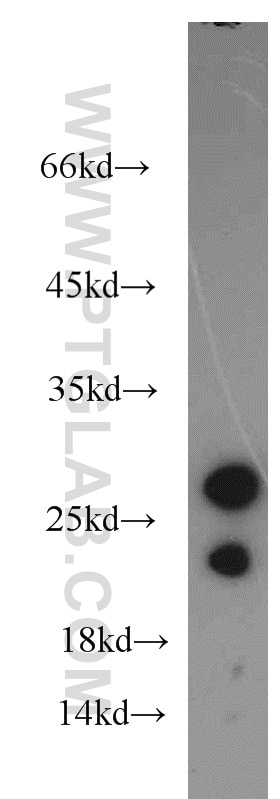 Western Blot (WB) analysis of mouse skeletal muscle tissue using MYL3 Polyclonal antibody (10913-1-AP)