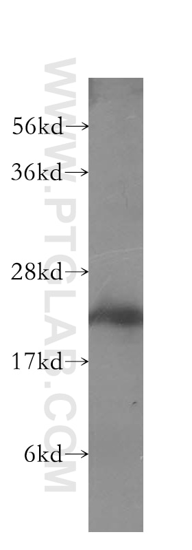 Western Blot (WB) analysis of human heart tissue using MYL3 Polyclonal antibody (10913-1-AP)