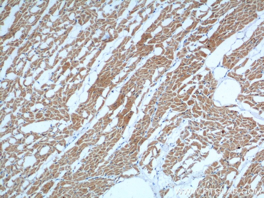 Immunohistochemistry (IHC) staining of human heart tissue using MYL3 Monoclonal antibody (66286-1-Ig)