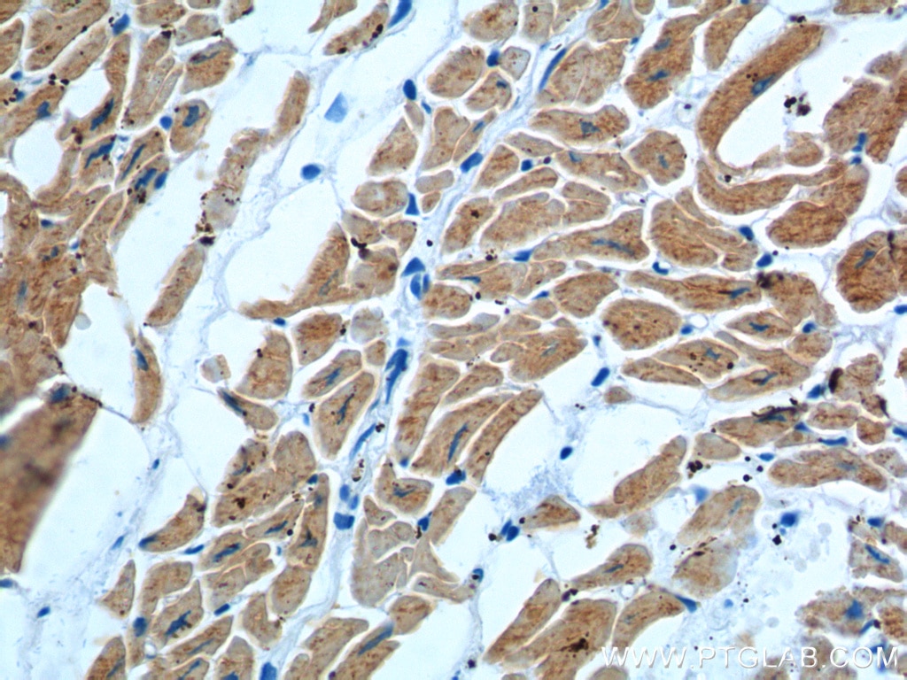 Immunohistochemistry (IHC) staining of human heart tissue using MYL3 Monoclonal antibody (66286-1-Ig)