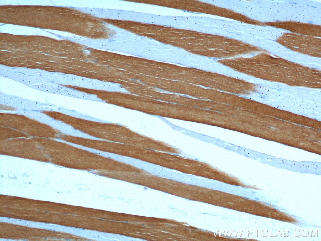 IHC staining of human skeletal muscle using 66286-1-Ig