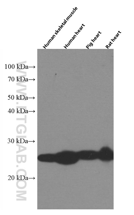 Western Blot (WB) analysis of various lysates using MYL3 Monoclonal antibody (66286-1-Ig)