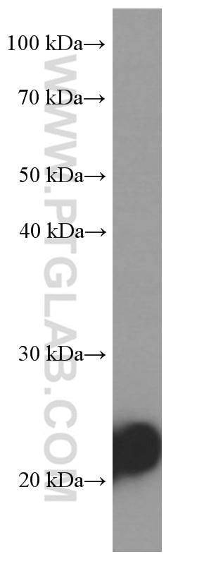 Western Blot (WB) analysis of human skeletal muscle tissue using MYL3 Monoclonal antibody (66286-1-Ig)