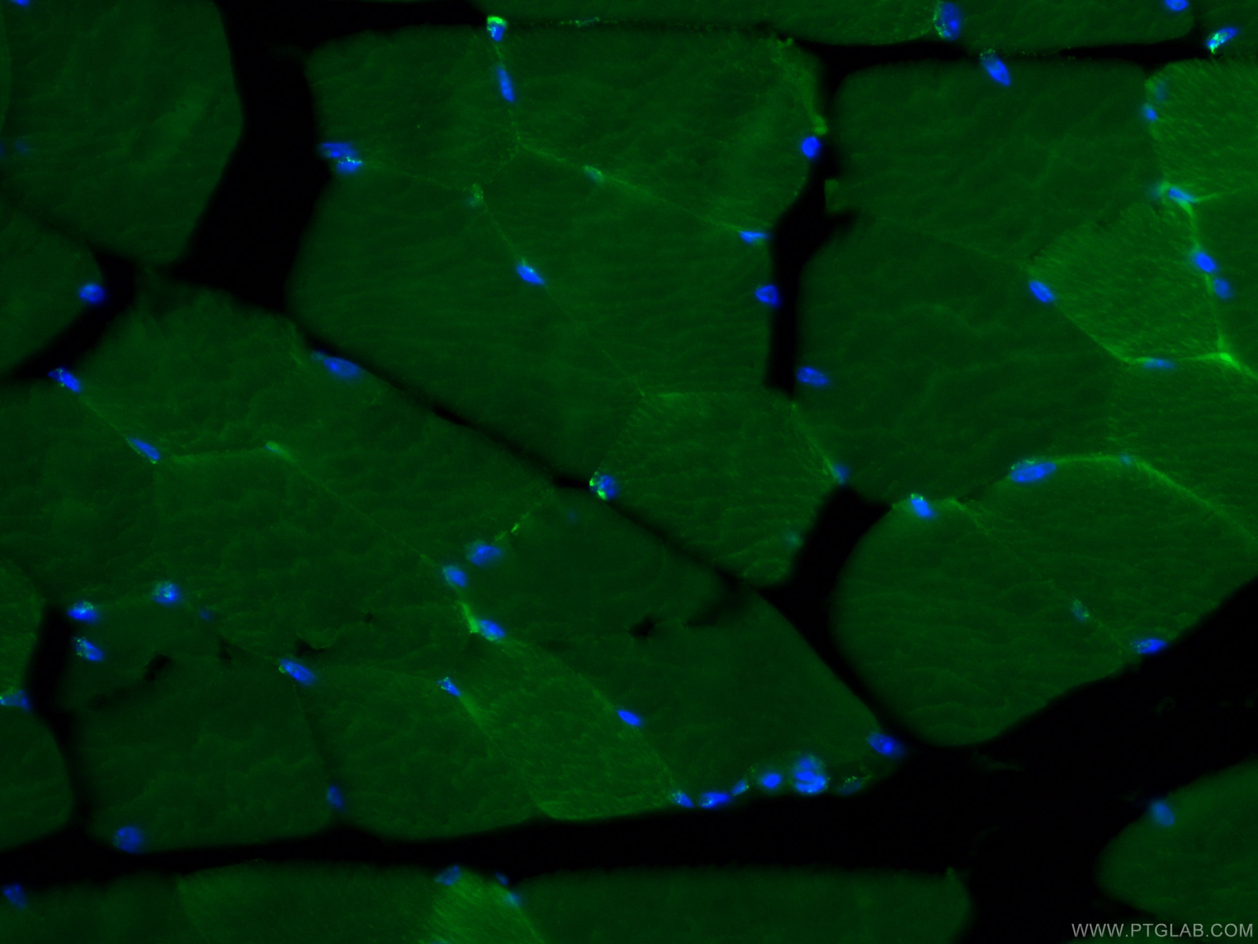 IF Staining of mouse skeletal muscle using CL488-66286