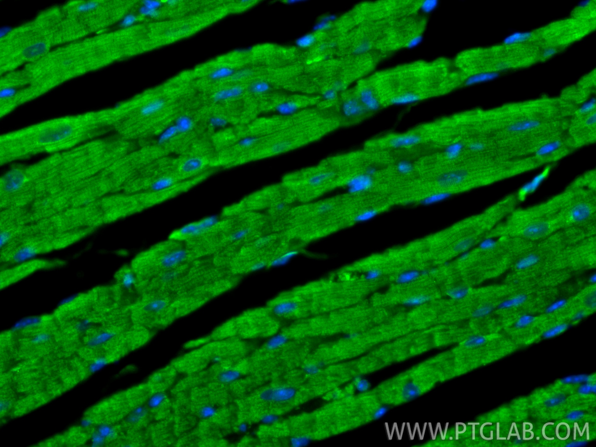 Immunofluorescence (IF) / fluorescent staining of mouse heart tissue using MYL4 Polyclonal antibody (13229-1-AP)