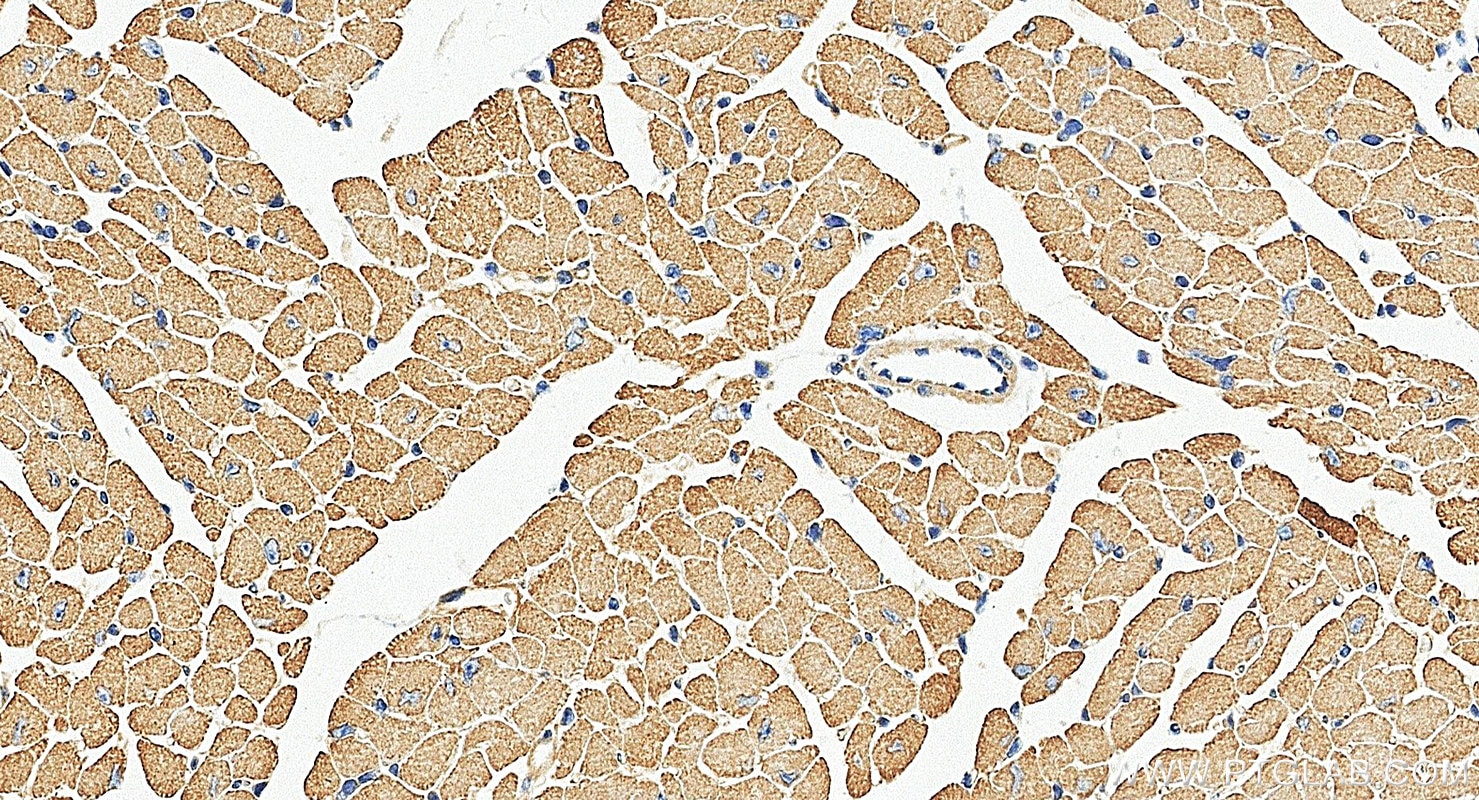 Immunohistochemistry (IHC) staining of mouse heart tissue using MYL4 Polyclonal antibody (13229-1-AP)