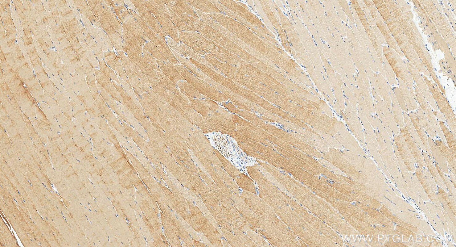 Immunohistochemistry (IHC) staining of mouse skeletal muscle tissue using MYL4 Polyclonal antibody (13229-1-AP)