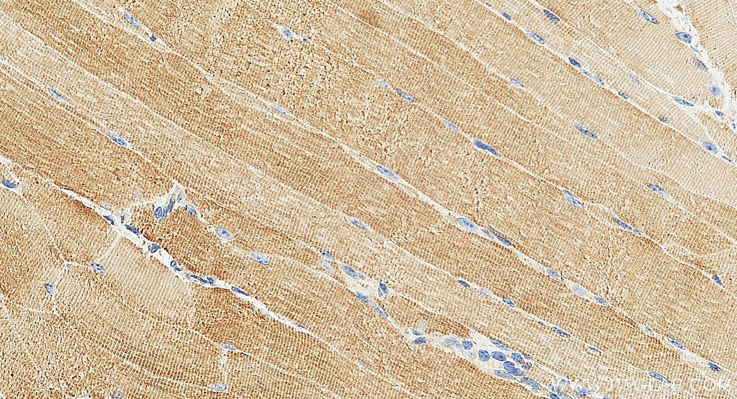 Immunohistochemistry (IHC) staining of mouse skeletal muscle tissue using MYL4 Polyclonal antibody (13229-1-AP)