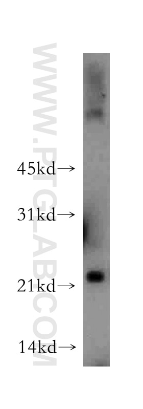 Western Blot (WB) analysis of human liver tissue using MYL4 Polyclonal antibody (13229-1-AP)