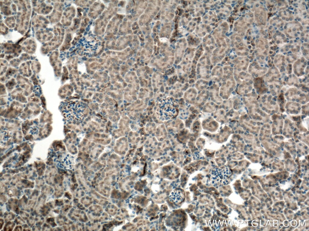 Immunohistochemistry (IHC) staining of mouse kidney tissue using MYL5 Polyclonal antibody (14249-1-AP)