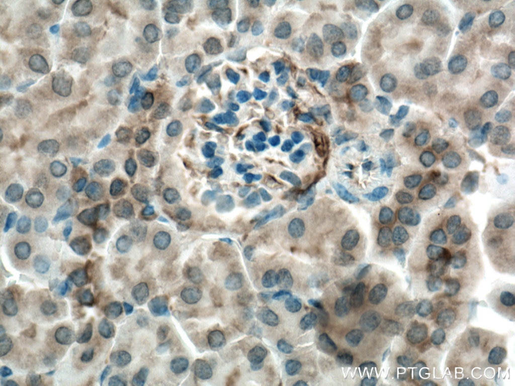 Immunohistochemistry (IHC) staining of mouse kidney tissue using MYL5 Polyclonal antibody (14249-1-AP)