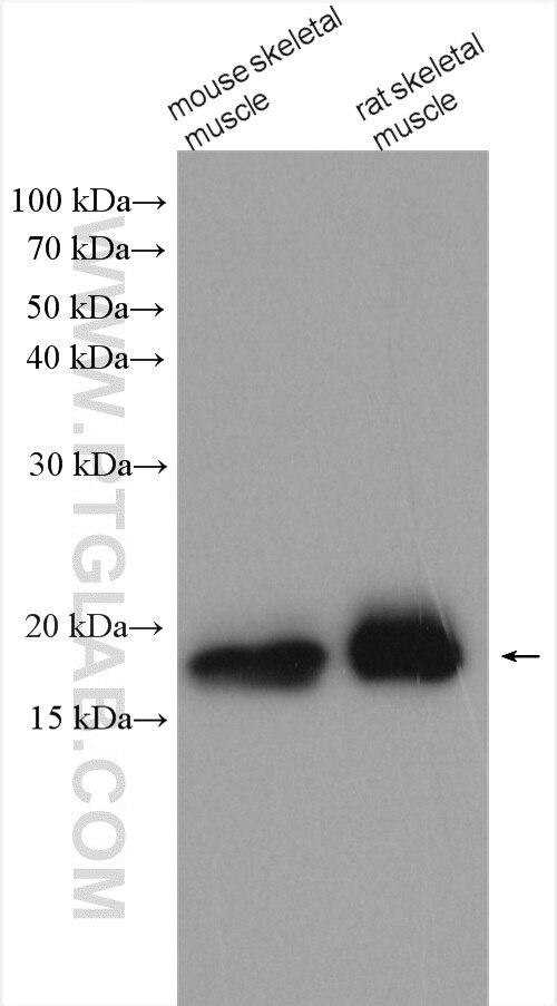 Western Blot (WB) analysis of various lysates using MYL5 Polyclonal antibody (14249-1-AP)