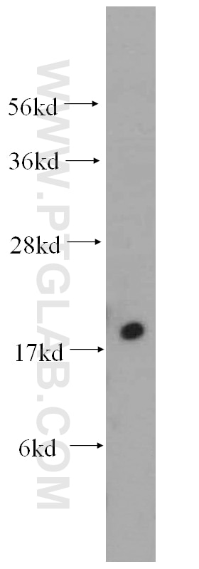 Western Blot (WB) analysis of human brain tissue using MYL5 Polyclonal antibody (14249-1-AP)