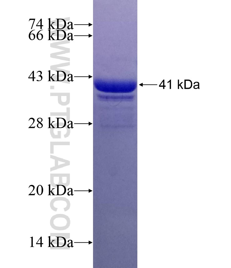 MYL5 fusion protein Ag5522 SDS-PAGE