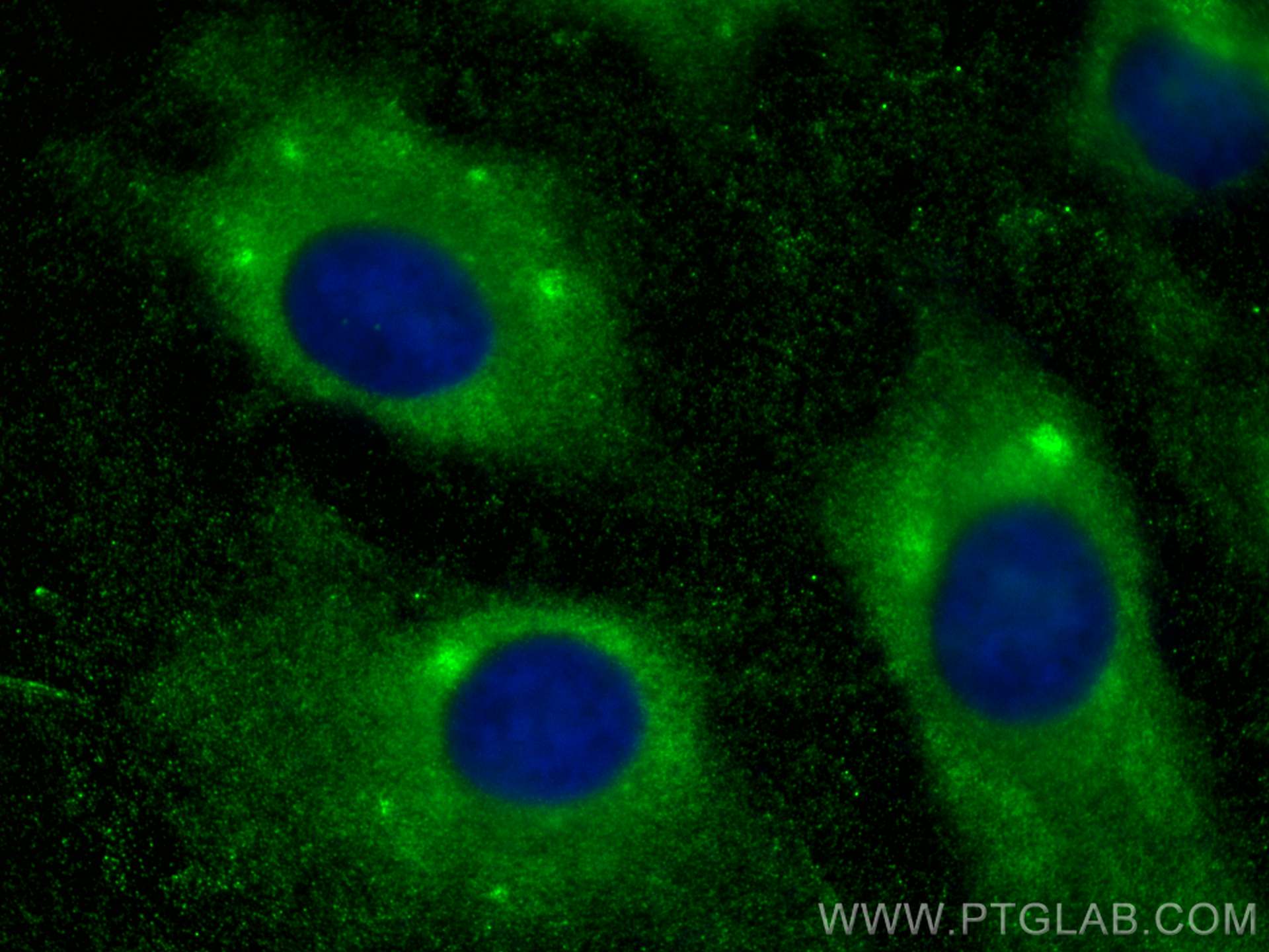 Immunofluorescence (IF) / fluorescent staining of HeLa cells using MYL6 Polyclonal antibody (18158-1-AP)