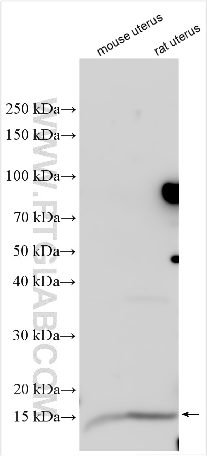 Western Blot (WB) analysis of various lysates using MYL6 Polyclonal antibody (18158-1-AP)