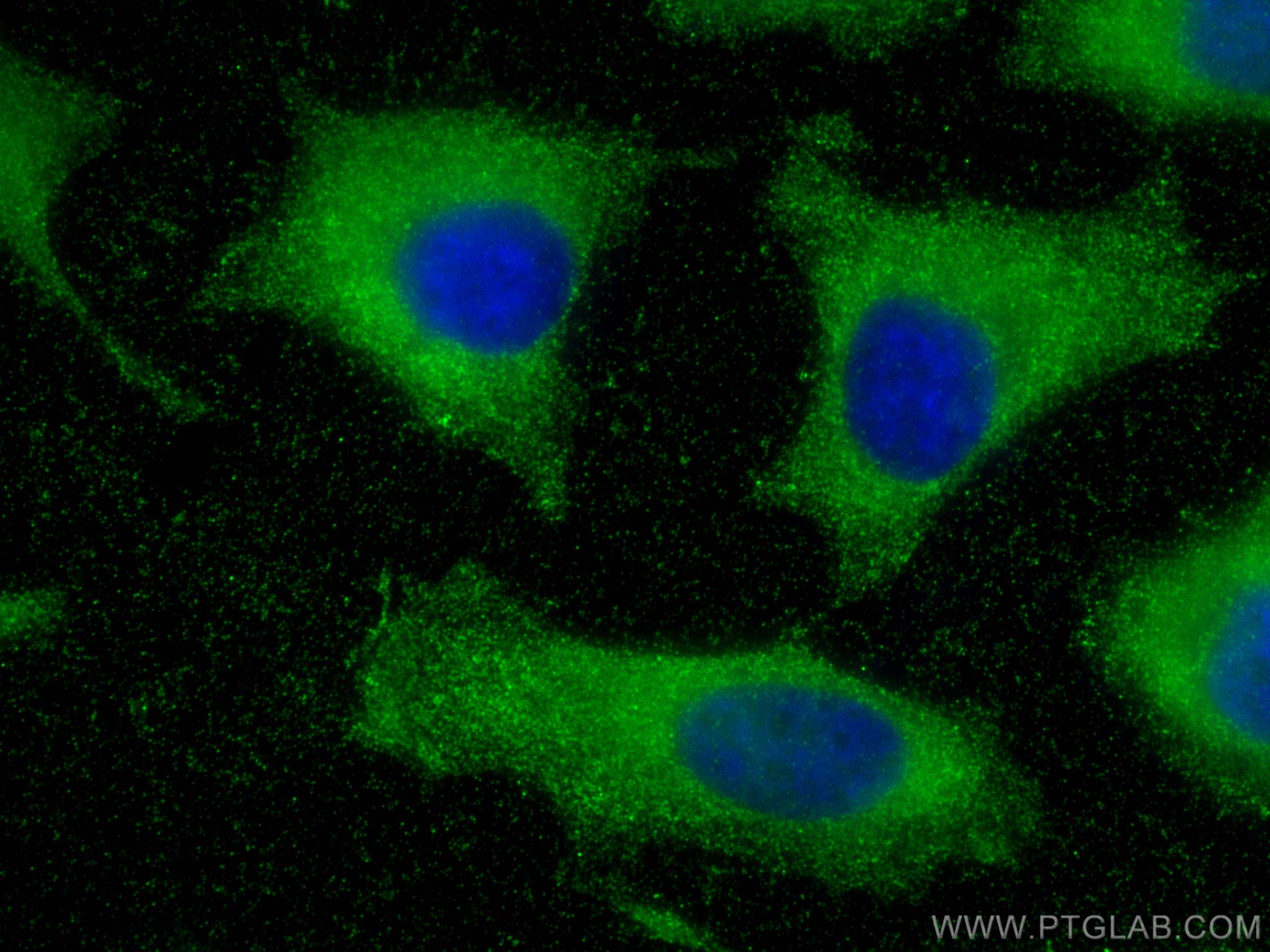 Immunofluorescence (IF) / fluorescent staining of HeLa cells using MYL6 Monoclonal antibody (68142-1-Ig)