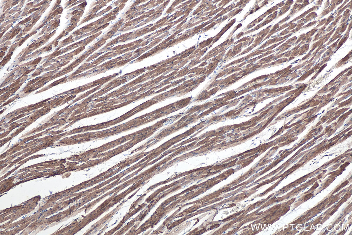 Immunohistochemistry (IHC) staining of rat heart tissue using MYL6 Monoclonal antibody (68142-1-Ig)