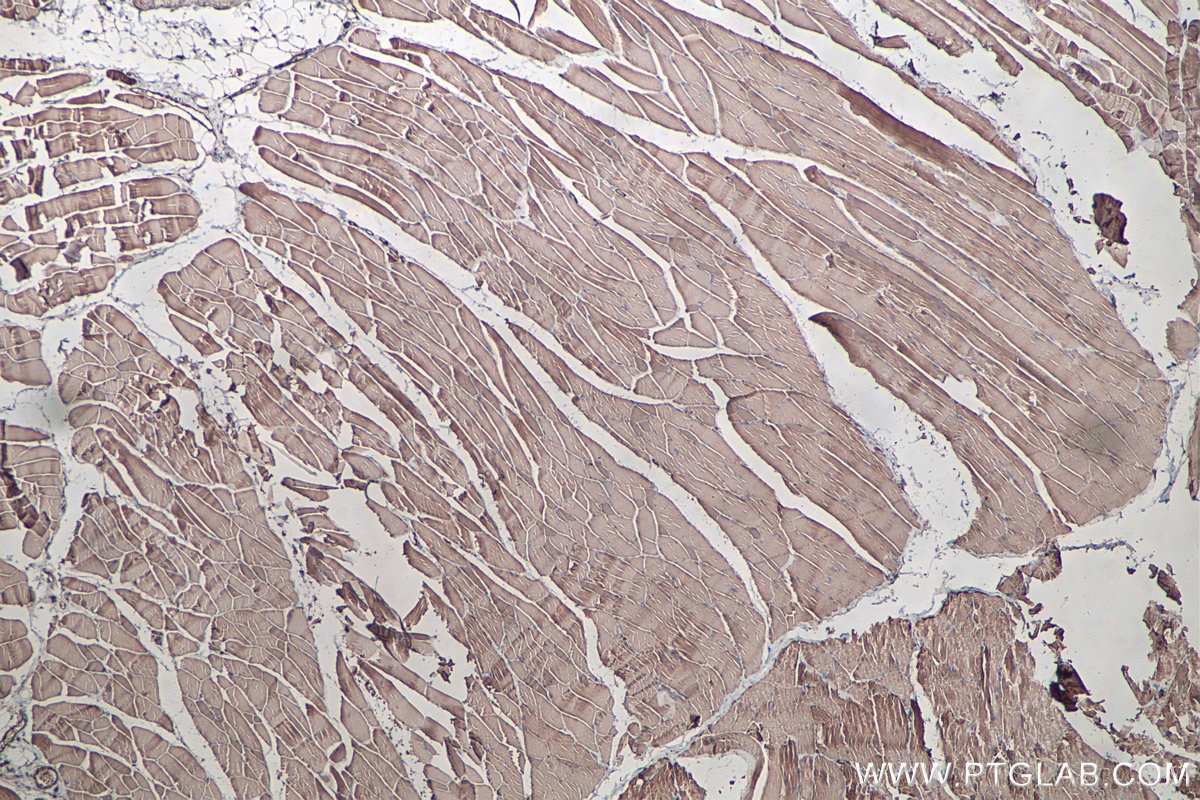 Immunohistochemistry (IHC) staining of rat skeletal muscle tissue using MYL6 Monoclonal antibody (68142-1-Ig)