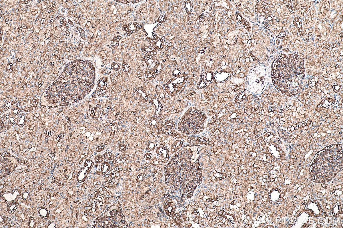 Immunohistochemistry (IHC) staining of human kidney tissue using MYL6 Monoclonal antibody (68142-1-Ig)