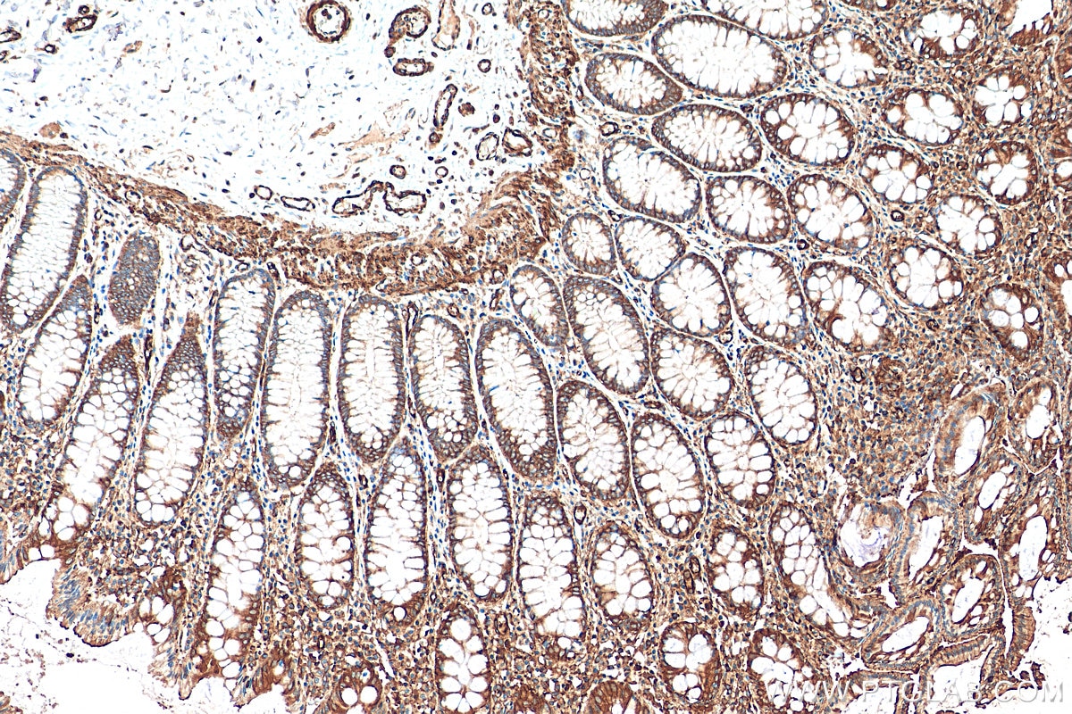 Immunohistochemistry (IHC) staining of human colon tissue using MYL6 Monoclonal antibody (68142-1-Ig)