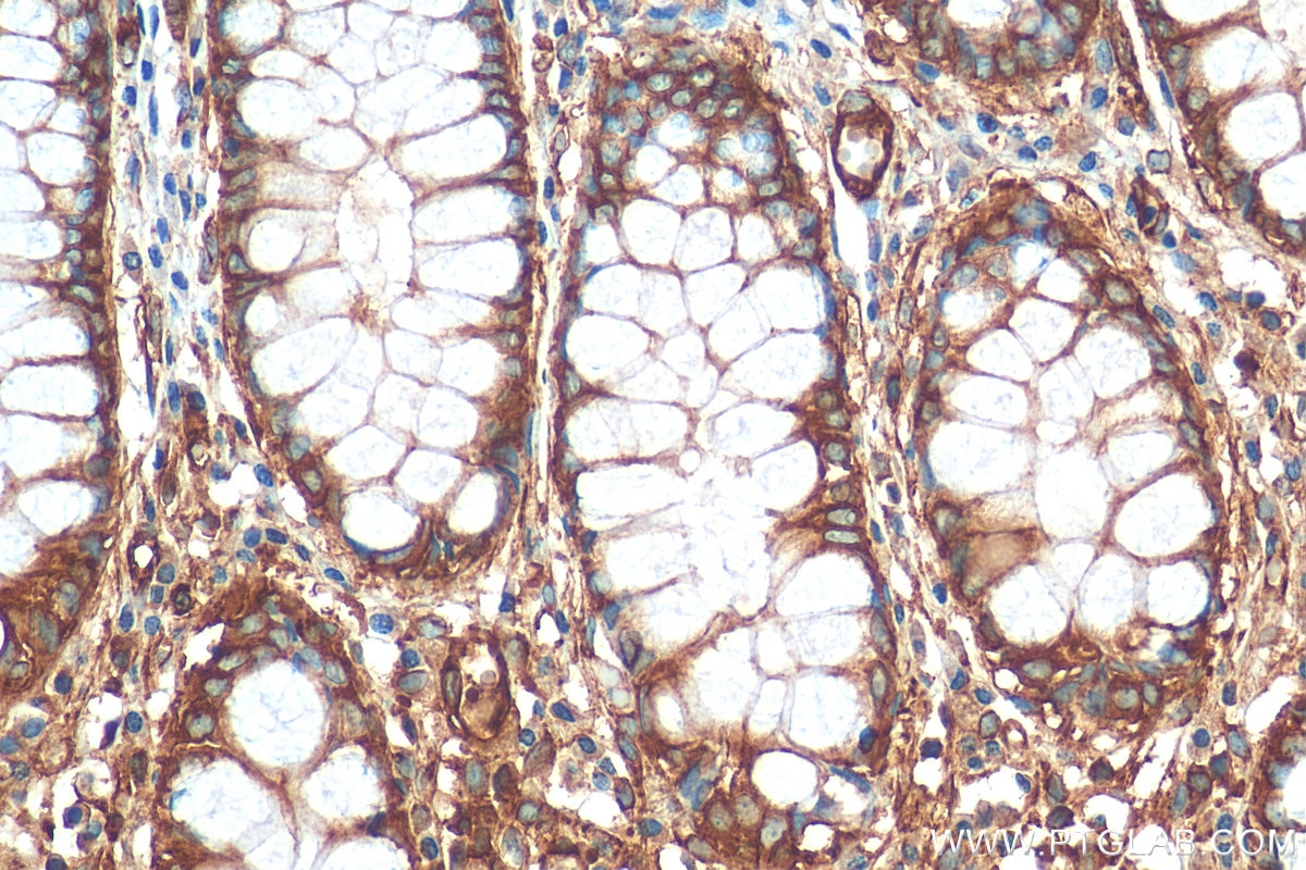 Immunohistochemistry (IHC) staining of human colon tissue using MYL6 Monoclonal antibody (68142-1-Ig)