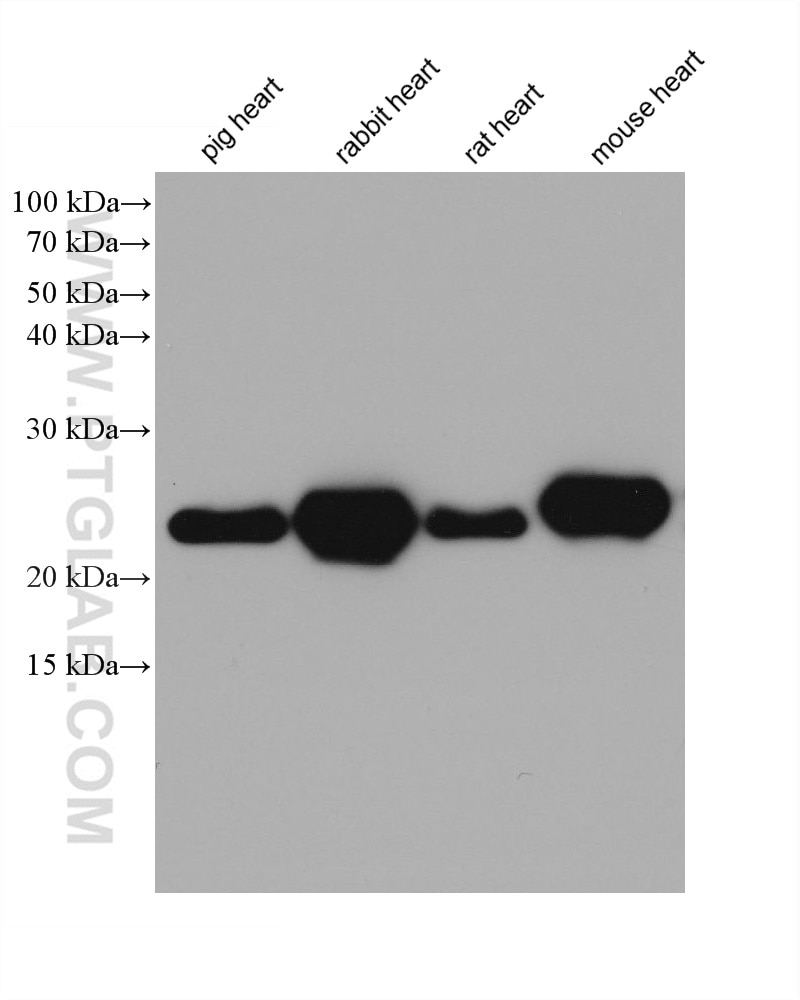 Western Blot (WB) analysis of various lysates using MYL6 Monoclonal antibody (68142-1-Ig)