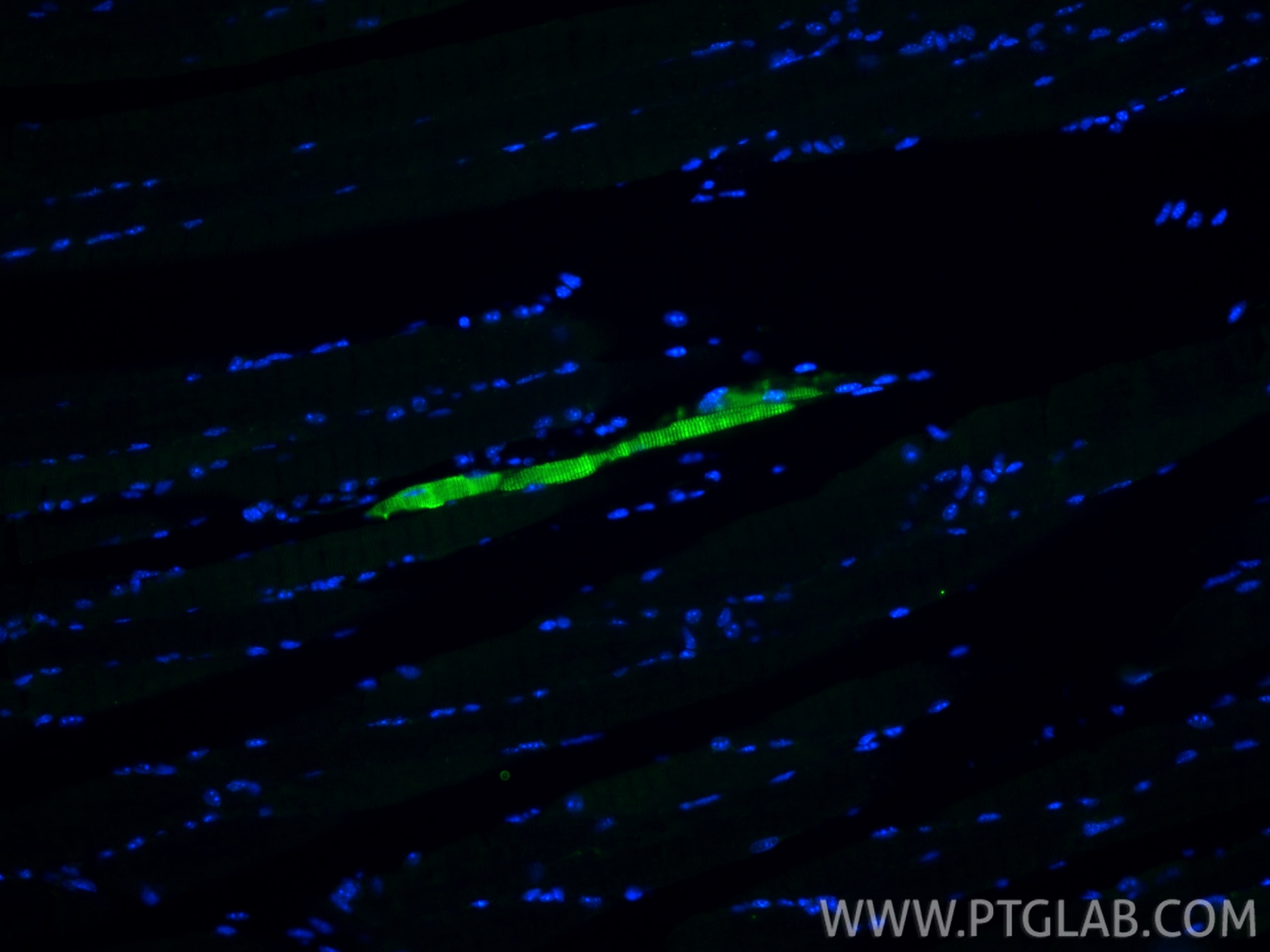 IF Staining of mouse skeletal muscle using 16963-1-AP Immunofluorescence (IF) / fluorescent staining of mouse skeletal muscle tissue using MYL6B Polyclonal antibody (16963-1-AP)