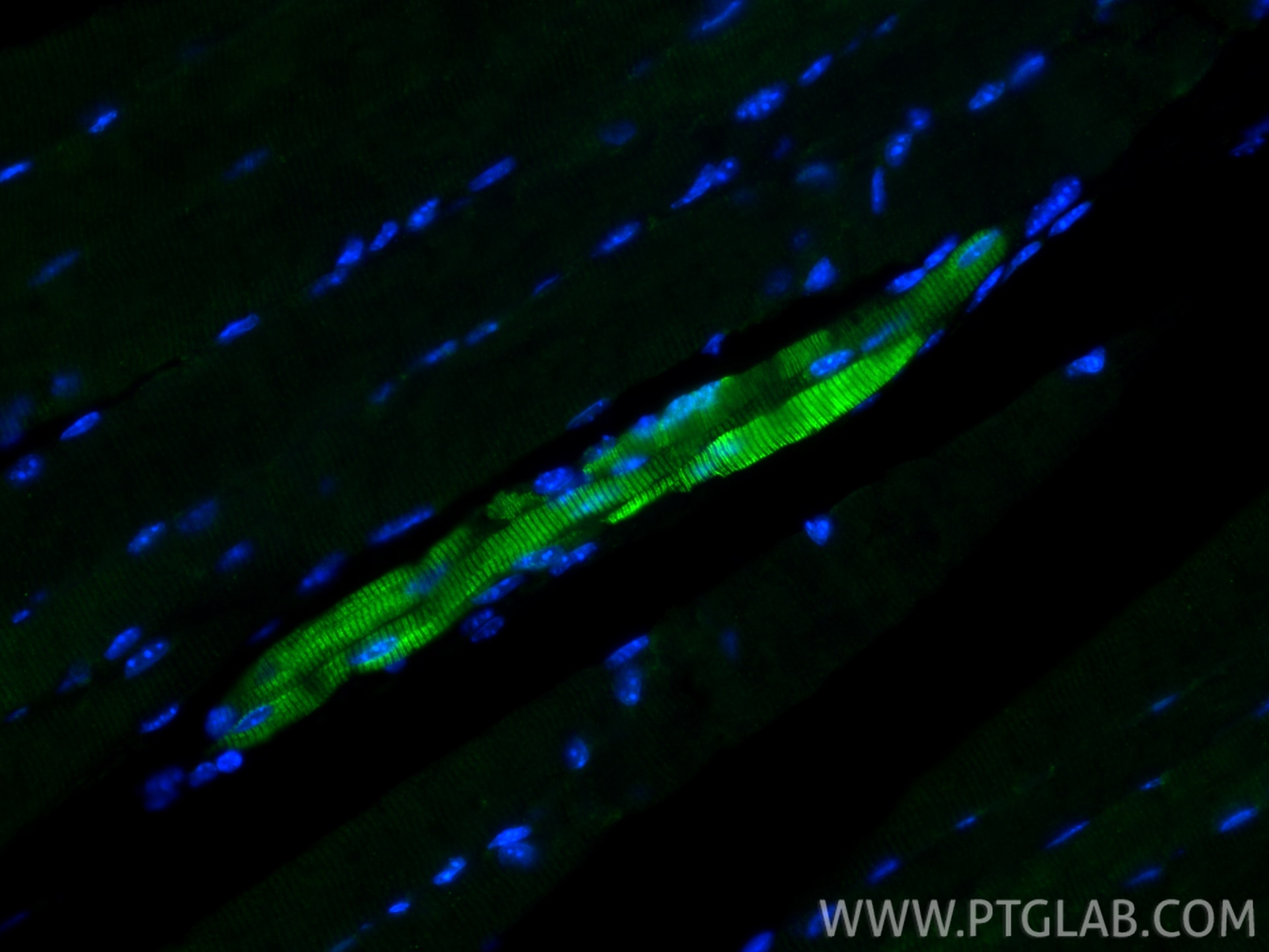 IF Staining of mouse skeletal muscle using 16963-1-AP Immunofluorescence (IF) / fluorescent staining of mouse skeletal muscle tissue using MYL6B Polyclonal antibody (16963-1-AP)