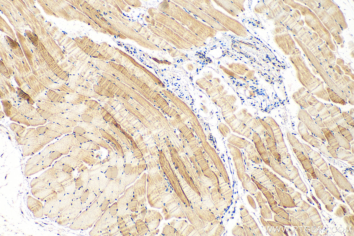 Immunohistochemistry (IHC) staining of mouse skeletal muscle tissue using MYL6B Polyclonal antibody (16963-1-AP)