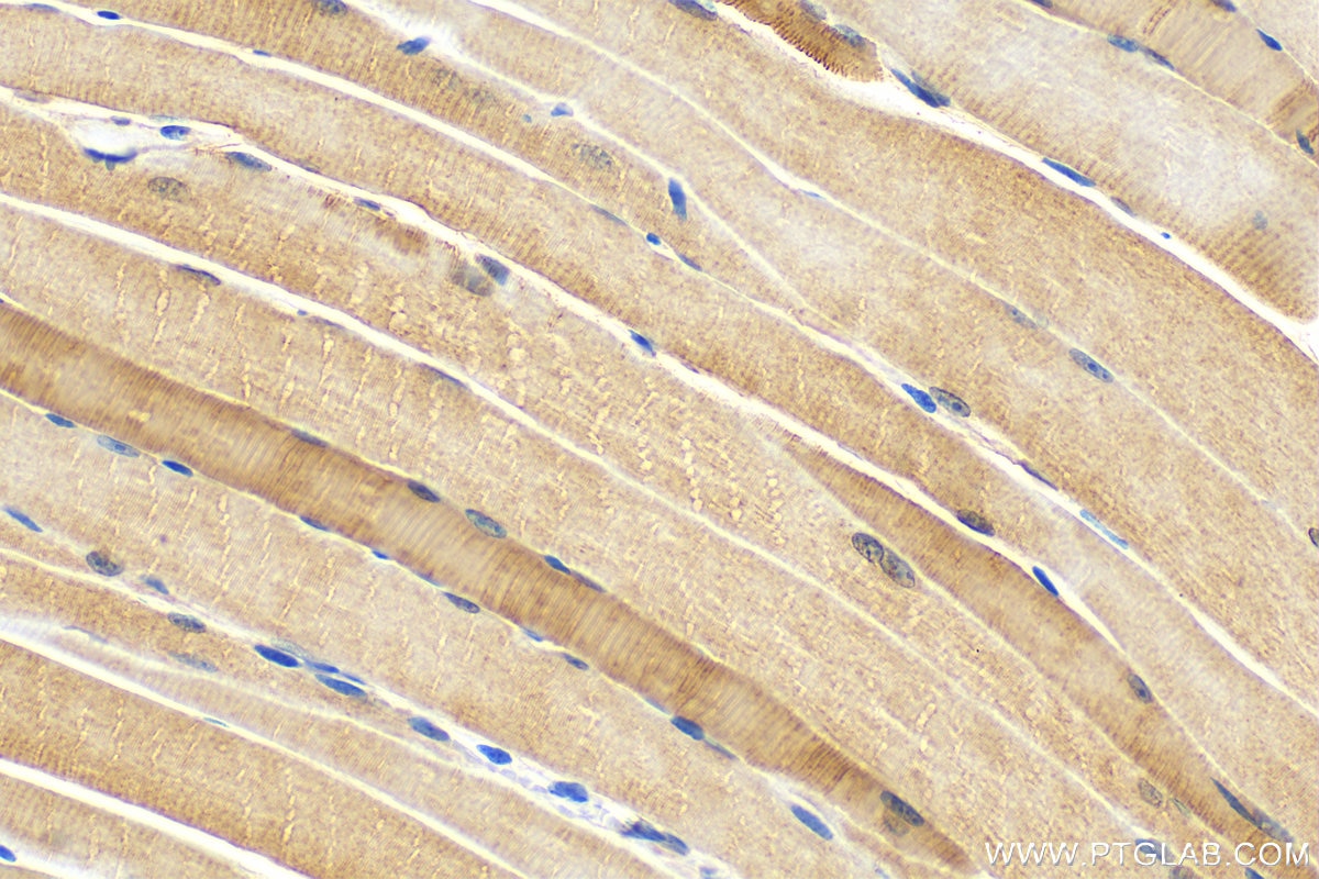 Immunohistochemistry (IHC) staining of mouse skeletal muscle tissue using MYL6B Polyclonal antibody (16963-1-AP)