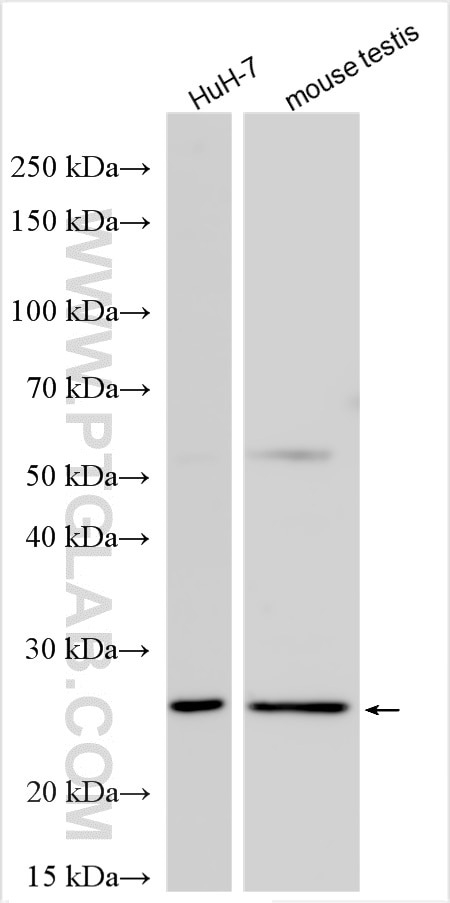 Western Blot (WB) analysis of various lysates using MYL6B Polyclonal antibody (16963-1-AP)