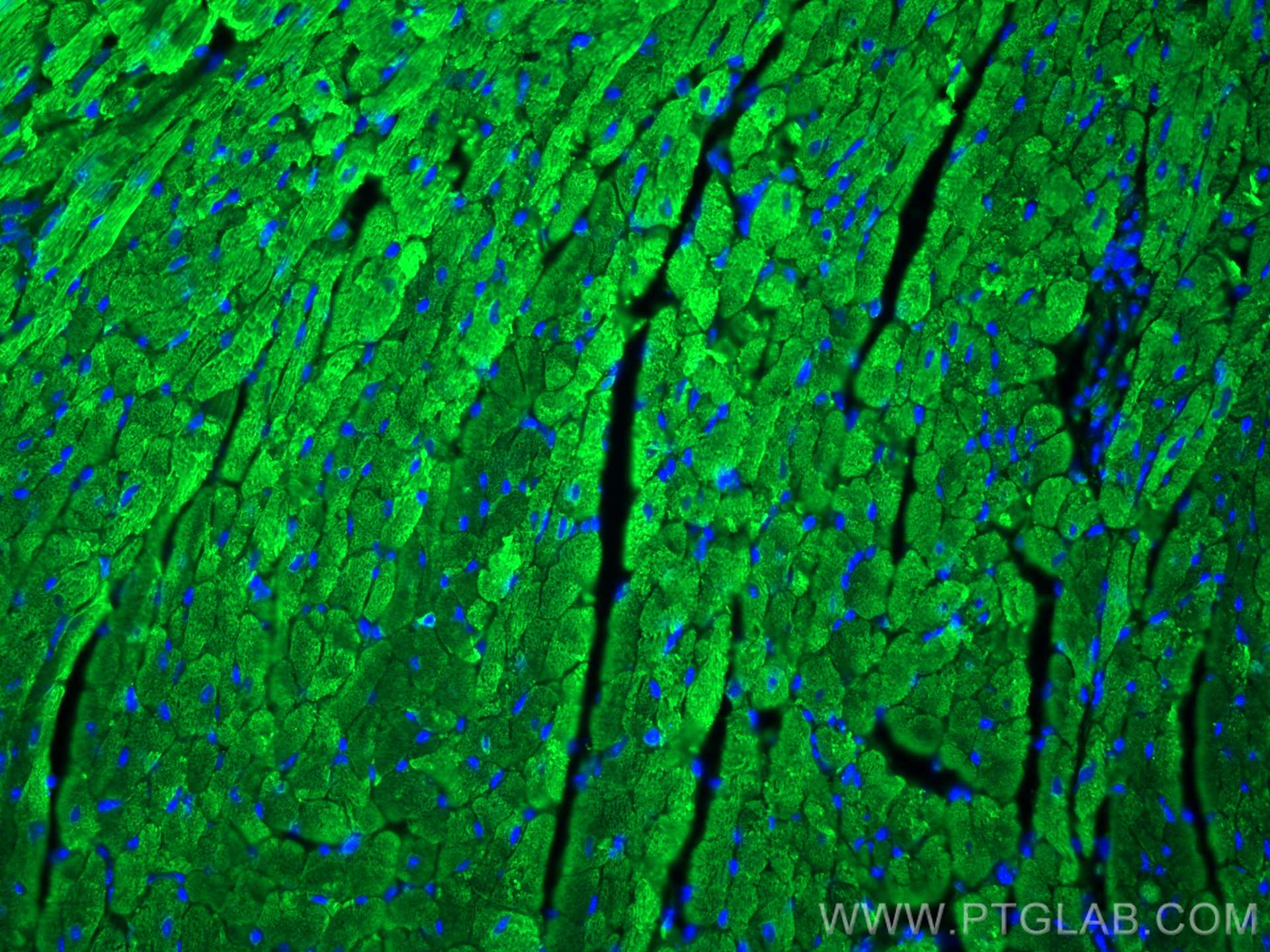 Immunofluorescence (IF) / fluorescent staining of mouse heart tissue using MYL7 Polyclonal antibody (17283-1-AP)