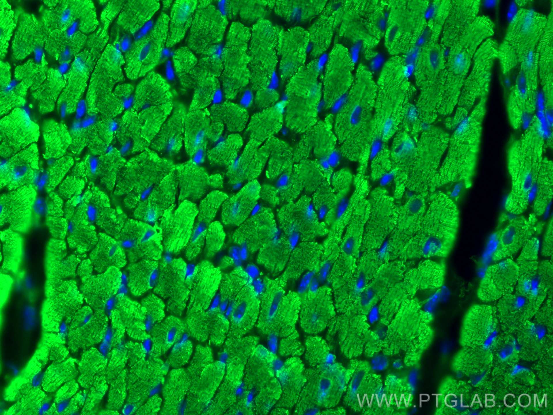 Immunofluorescence (IF) / fluorescent staining of mouse heart tissue using MYL7 Polyclonal antibody (17283-1-AP)