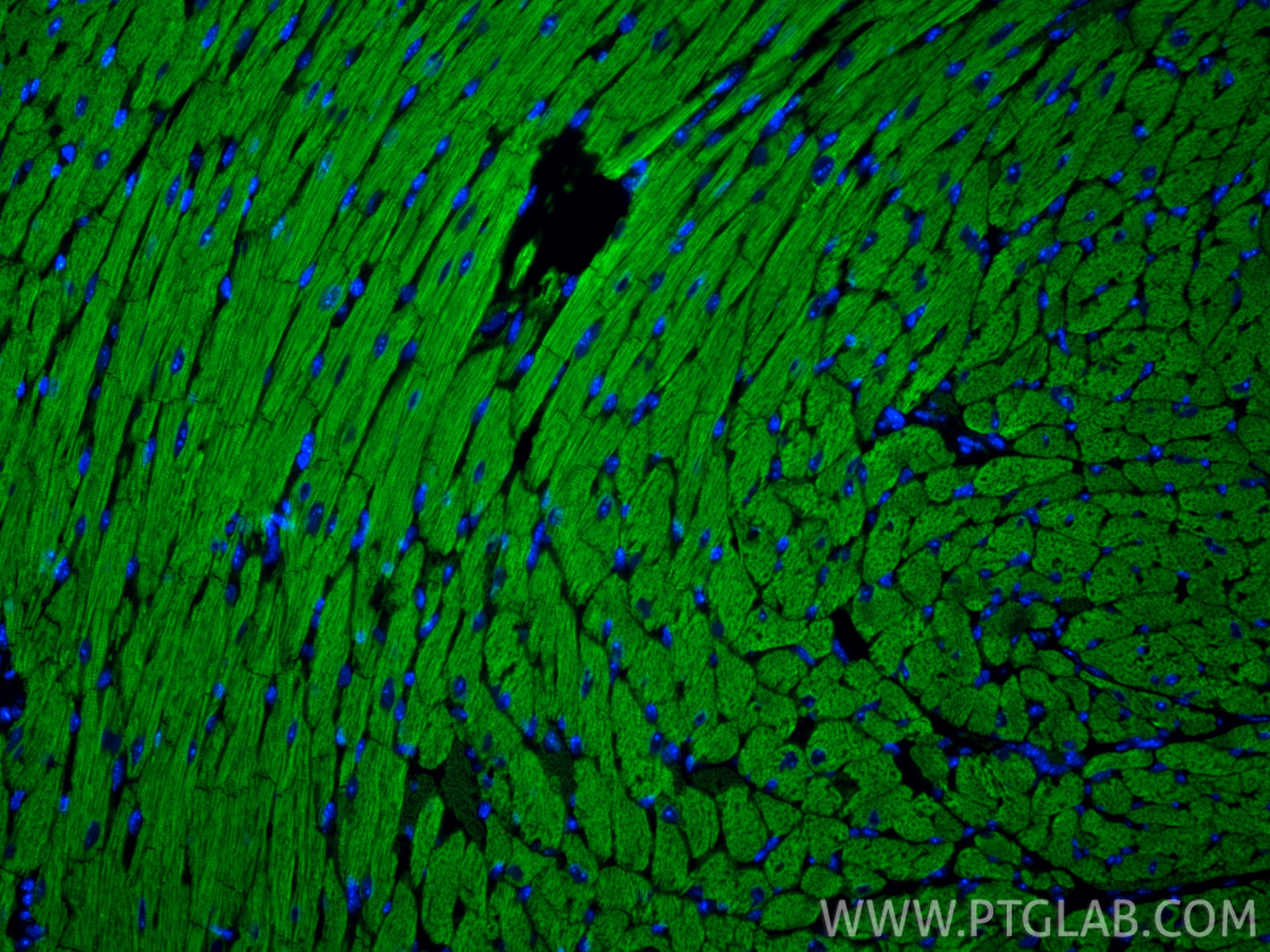 Immunofluorescence (IF) / fluorescent staining of mouse heart tissue using MYL7 Polyclonal antibody (17283-1-AP)