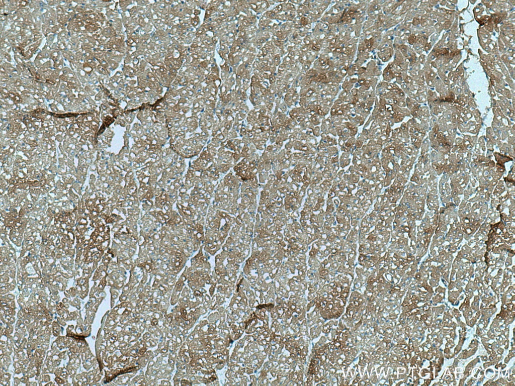 Immunohistochemistry (IHC) staining of human heart tissue using MYL7 Polyclonal antibody (17283-1-AP)