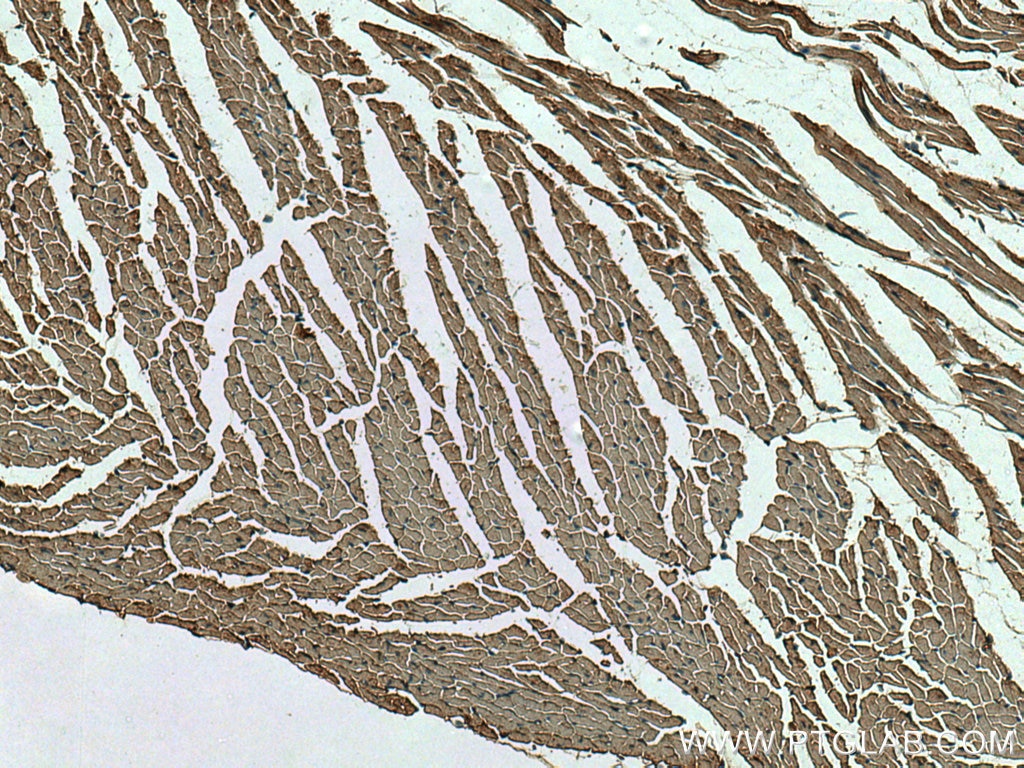 Immunohistochemistry (IHC) staining of mouse heart tissue using MYL7 Polyclonal antibody (17283-1-AP)