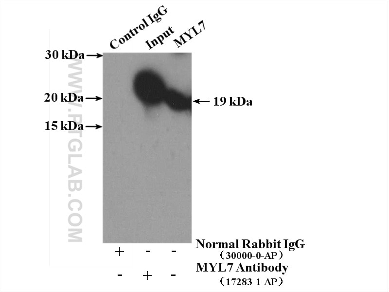 IP experiment of mouse heart using 17283-1-AP