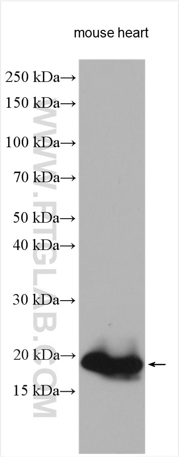 Western Blot (WB) analysis of various lysates using MYL7 Polyclonal antibody (17283-1-AP)