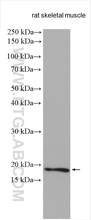 Western Blot (WB) analysis of various lysates using MYL7 Polyclonal antibody (17283-1-AP)