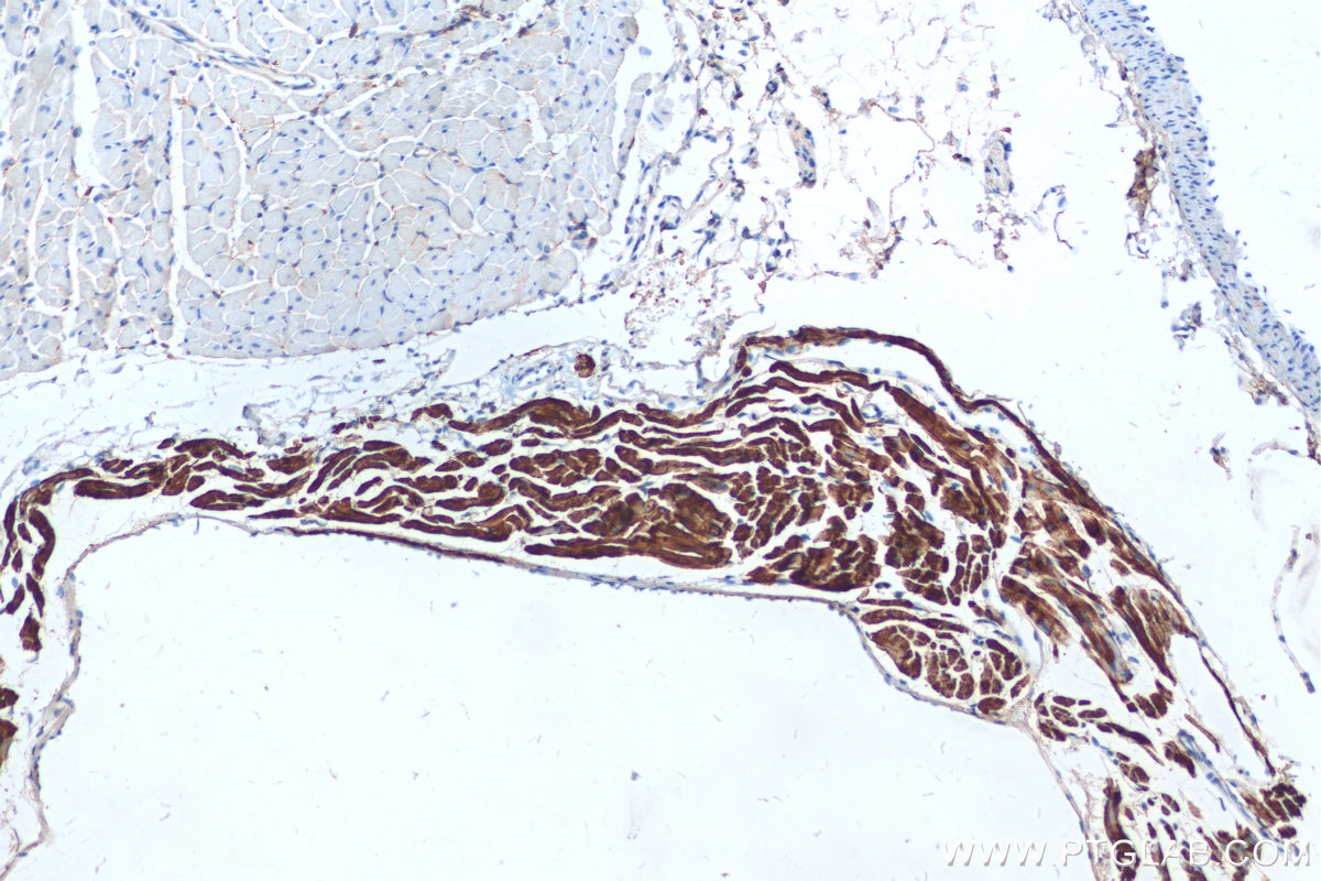 Immunohistochemistry (IHC) staining of mouse heart tissue using MYL7 Recombinant antibody (81570-1-RR)