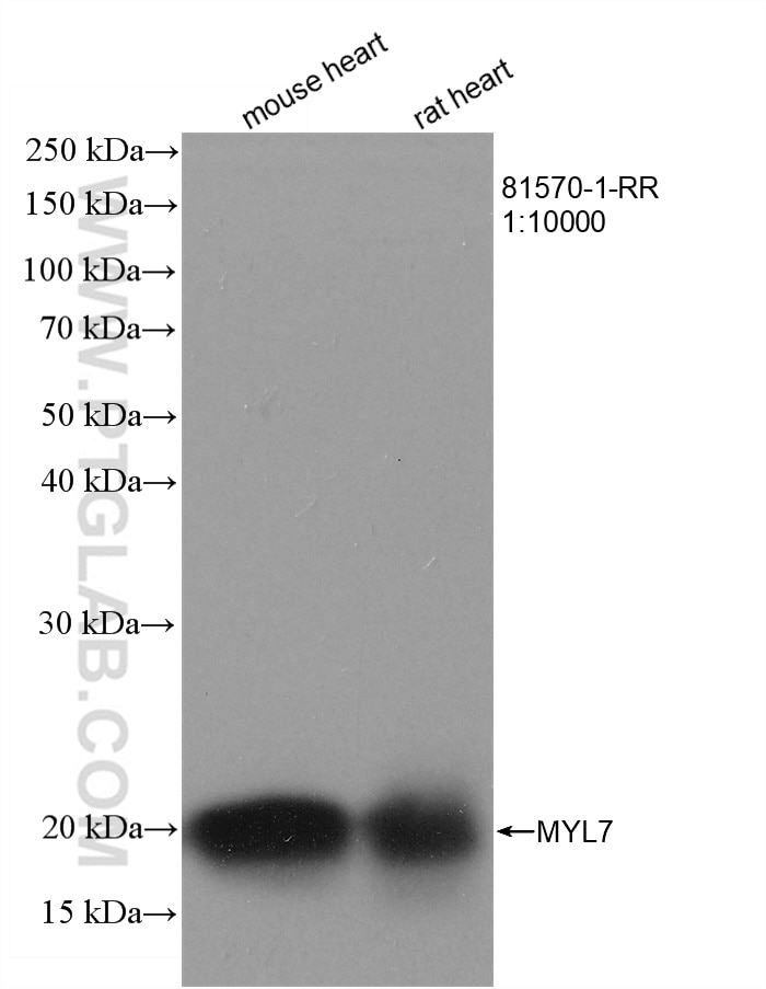 Western Blot (WB) analysis of various lysates using MYL7 Recombinant antibody (81570-1-RR)