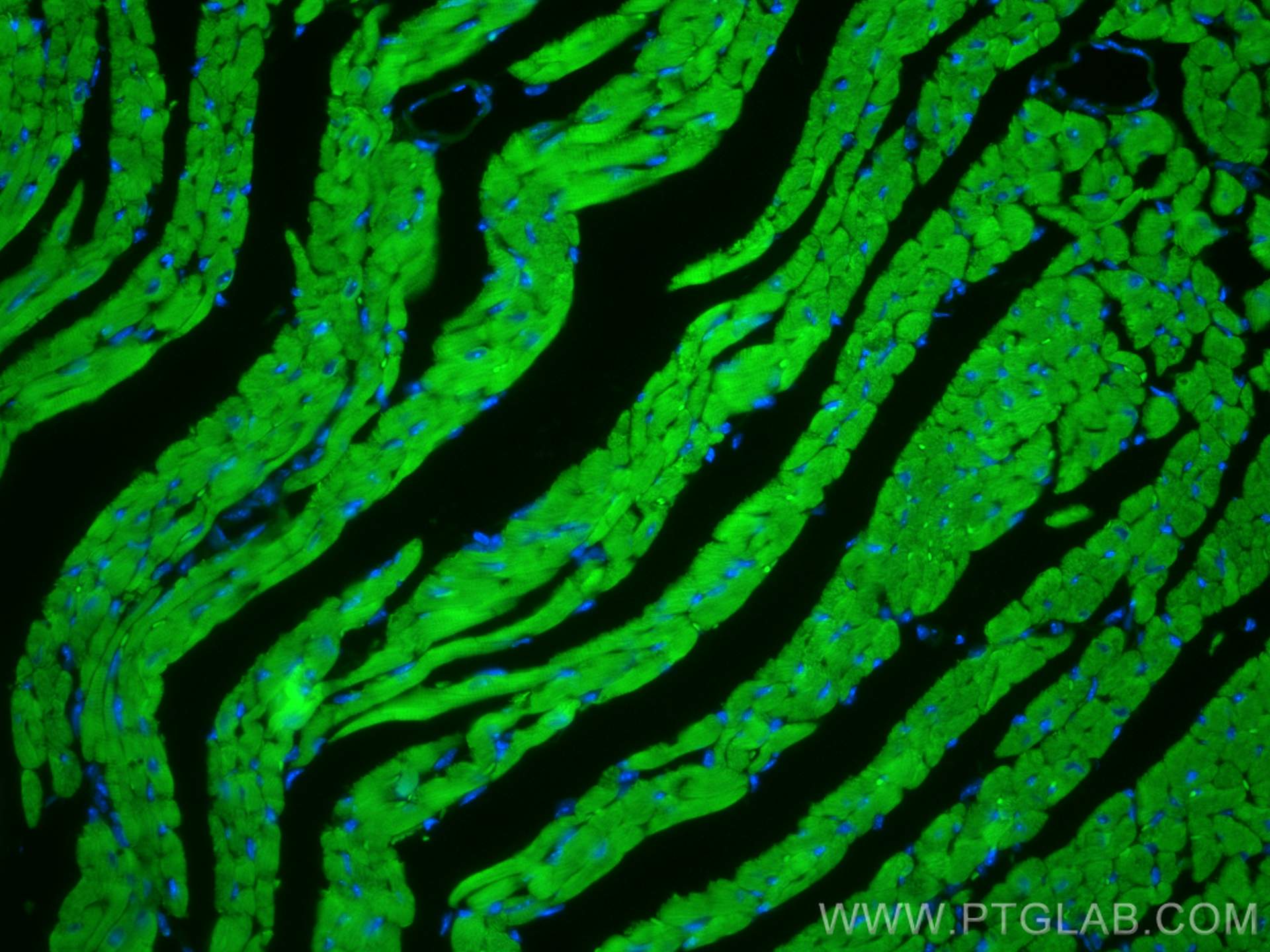 Immunofluorescence (IF) / fluorescent staining of mouse heart tissue using CoraLite® Plus 488-conjugated MYL7 Polyclonal anti (CL488-17283)