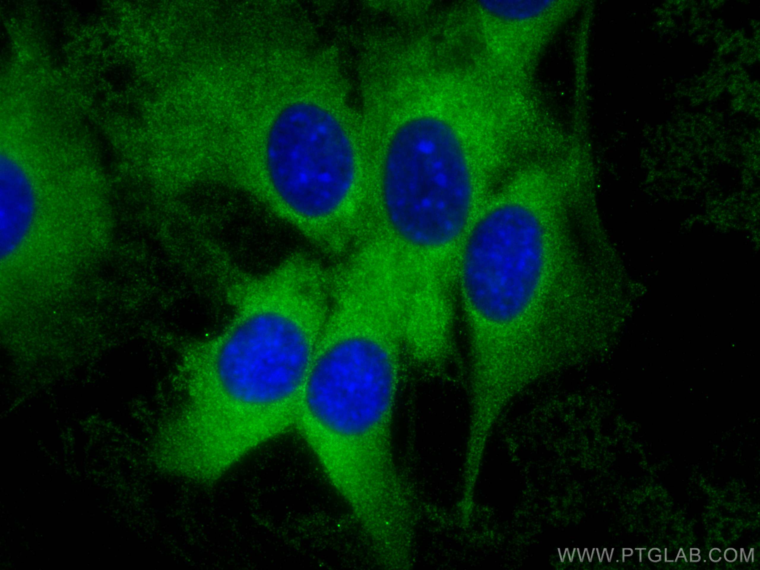 Immunofluorescence (IF) / fluorescent staining of C2C12 cells using MYL9 Polyclonal antibody (15354-1-AP)