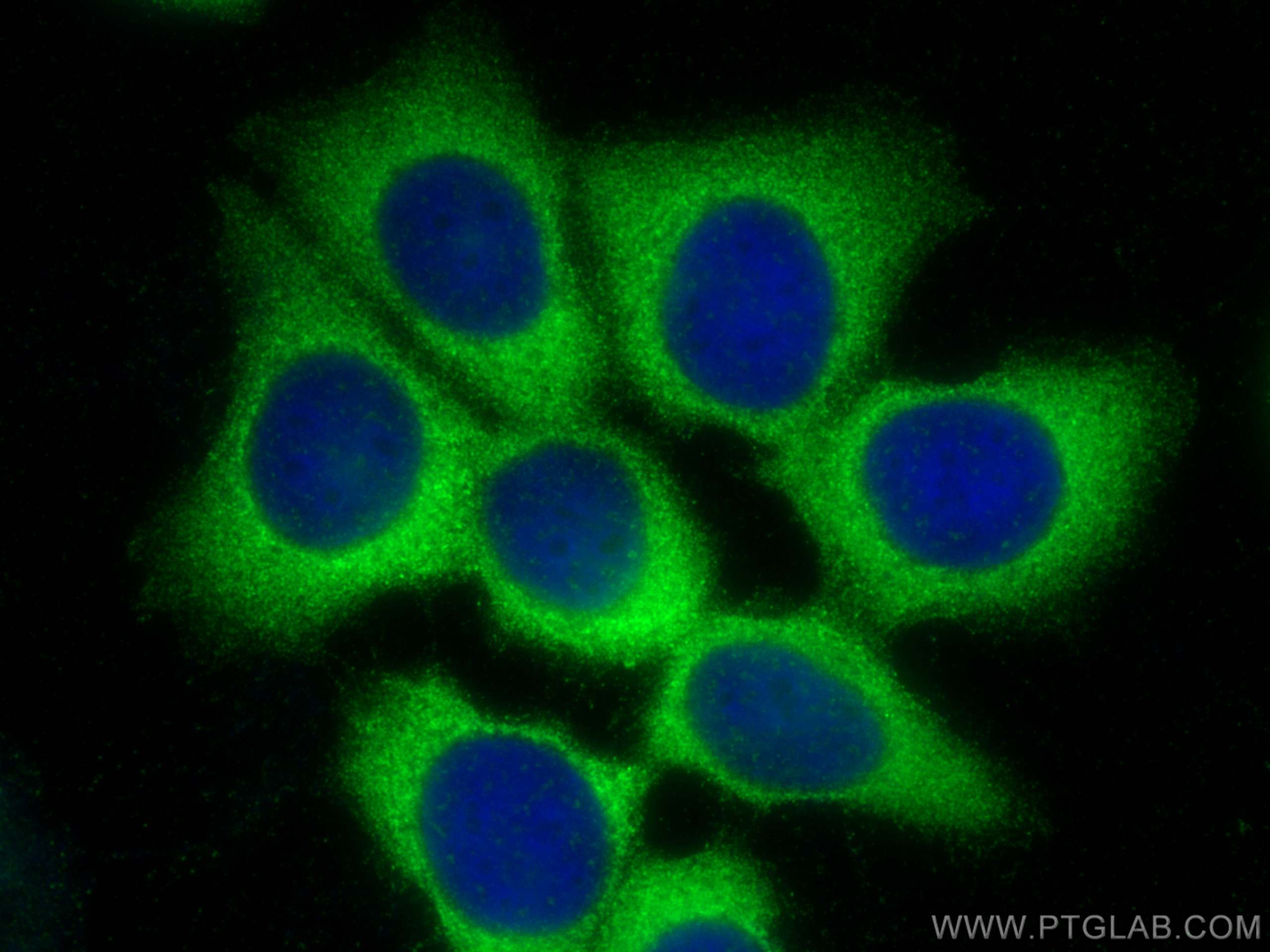 Immunofluorescence (IF) / fluorescent staining of MCF-7 cells using MYL9 Polyclonal antibody (15354-1-AP)
