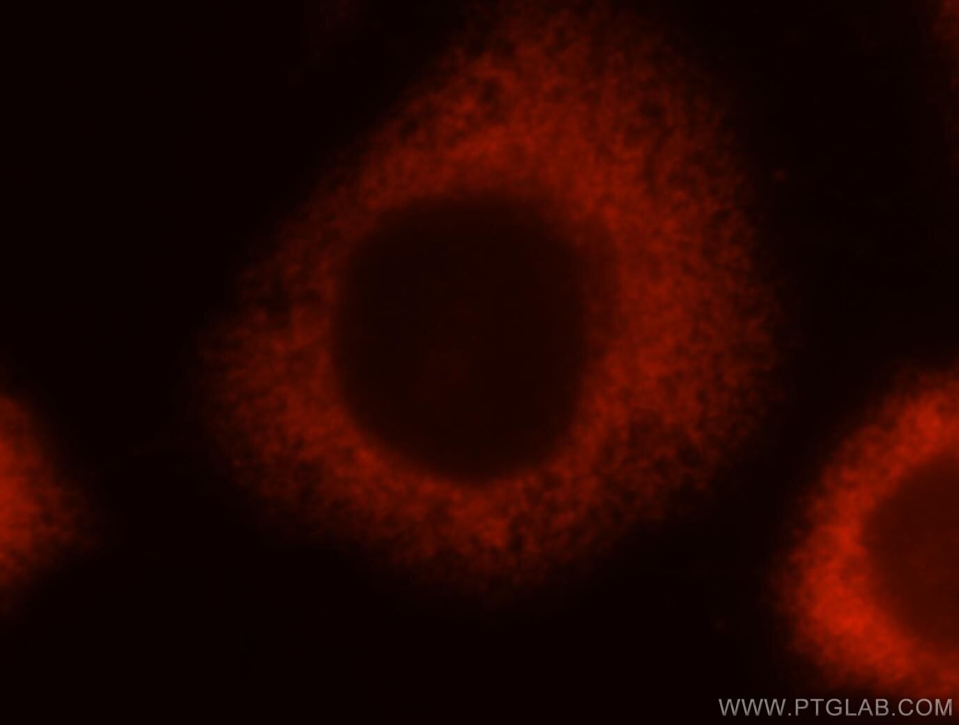 Immunofluorescence (IF) / fluorescent staining of MCF-7 cells using MYL9 Polyclonal antibody (15354-1-AP)