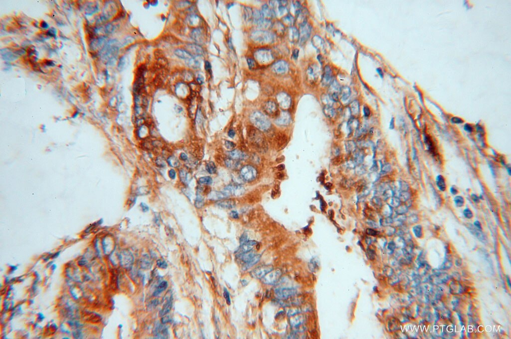 MYL9 Polyclonal antibody