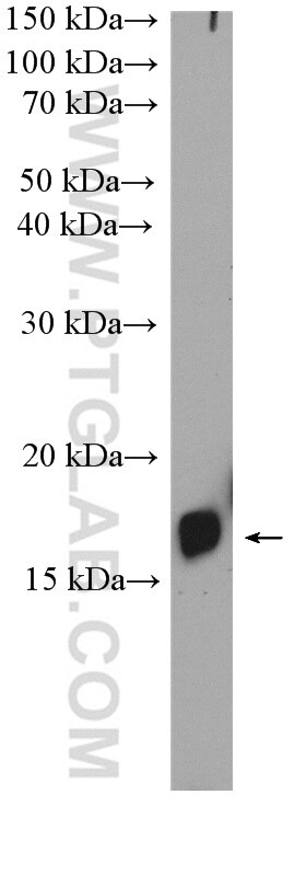 Western Blot (WB) analysis of Caco-2 cells using MYL9 Polyclonal antibody (15354-1-AP)