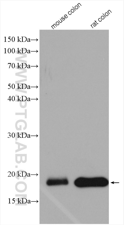 Western Blot (WB) analysis of various lysates using MYL9 Polyclonal antibody (15354-1-AP)